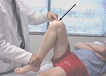 Smerte i kneet under bøyning er den vanligste grunnen til at folk besøker traumatiske leger. 